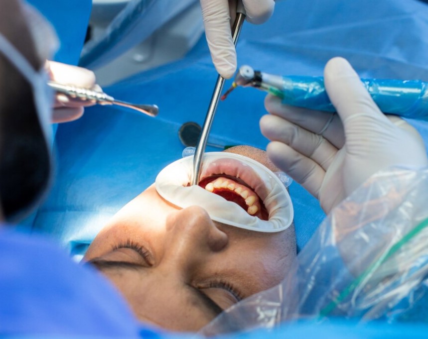 Paciente en mitad de una cirugía dental 