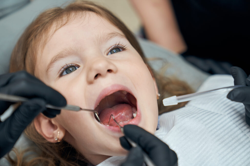 Niña abriendo la boca mientras los dentistas le miran los dientes