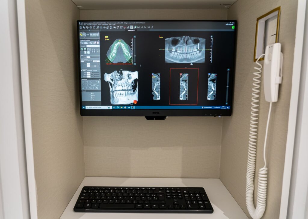ordenador en la clinica dentista con varias radiografias de los dientes de un paciente